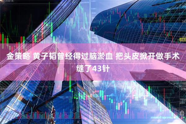 金策略 黄子韬曾经得过脑淤血 把头皮掀开做手术缝了43针